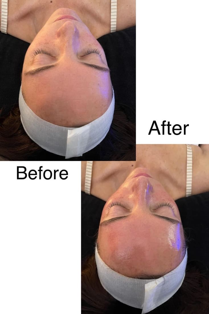 Facial before and after: client skin brighter and more hydrated after a facial