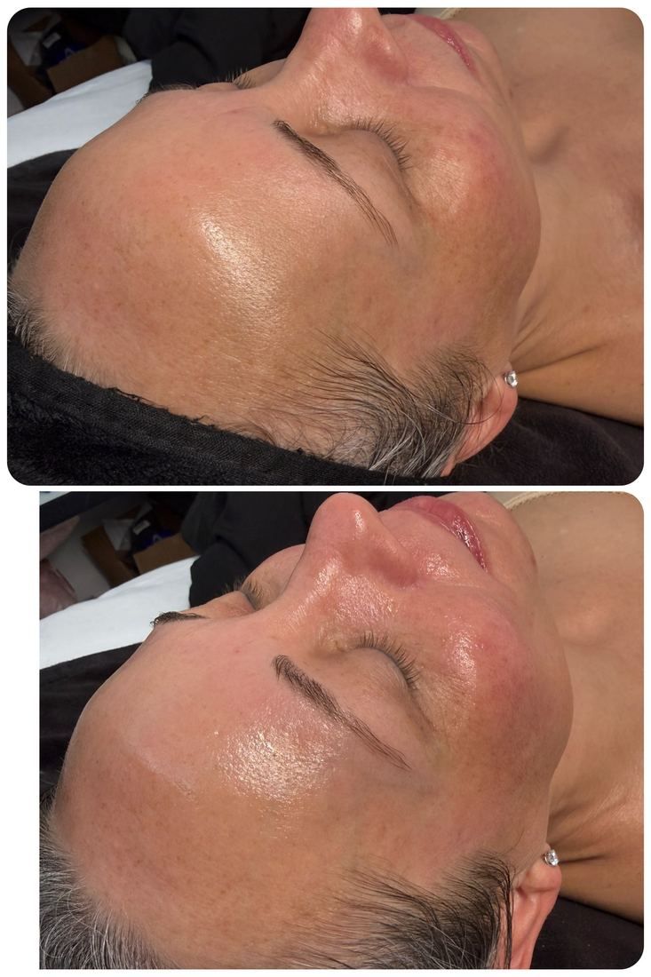 Facial before and after: smoother, glowing client skin after a facial